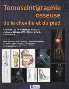 Cover of the book TOMOSCINTIGRAPHIE OSSEUSE DE LA CHEVILLE ET DU PIED