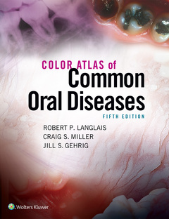 Couverture de l’ouvrage Color Atlas of Common Oral Diseases 