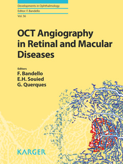 Couverture de l’ouvrage OCT Angiography in Retinal and Macular Diseases