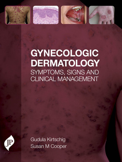 Couverture de l’ouvrage Gynecologic Dermatology