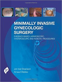 Couverture de l’ouvrage Minimally Invasive Gynecologic Surgery: Evidence-Based Laparoscopic, Hysteroscopic & Robotic Surgeries