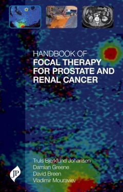 Couverture de l’ouvrage Handbook of Focal Therapy for Prostate and Renal Cancer