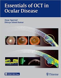 Cover of the book Essentials of OCT in Ocular Disease