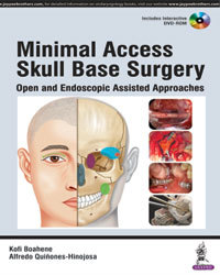 Cover of the book Minimal Access Skull Base Surgery