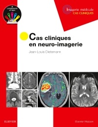 Couverture de l’ouvrage Cas cliniques en neuro-imagerie