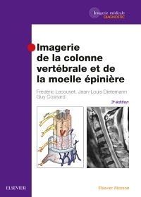 Cover of the book Imagerie de la colonne vertébrale et de la moelle épinière