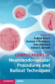 Cover of the book Complications of Neuroendovascular Procedures and Bailout Techniques