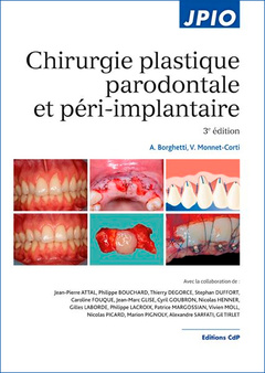 Couverture de l’ouvrage Chirurgie plastique parodontale et péri-implantaire
