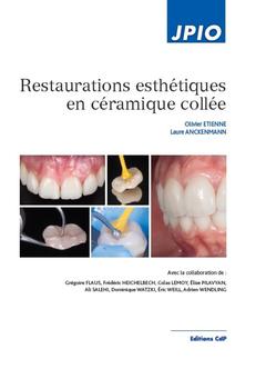 Cover of the book Restaurations esthétiques en céramique collée