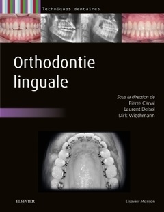 Couverture de l’ouvrage Orthodontie linguale