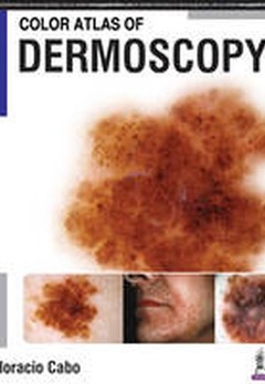 Cover of the book Color Atlas of Dermoscopy