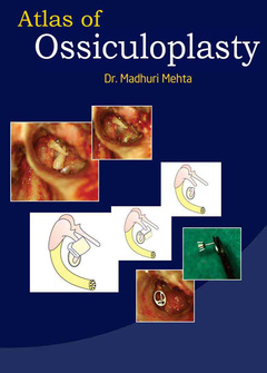 Couverture de l’ouvrage Atlas of Ossiculoplasty