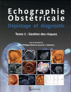 Cover of the book ECHOGRAPHIE OBSTETRICALE. DEPISTAGE ET DIAGNOSTIC TOM 1 GESTION DES RISQUES
