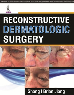 Couverture de l’ouvrage Reconstructive Dermatologic Surgery