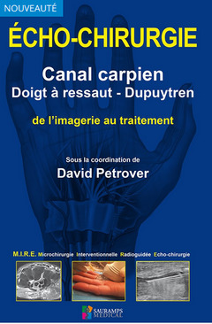 Cover of the book ECHO-CHIRURGIE CANAL CARPIEN, DOIGT A RESSAUT ET DUPUYTREN