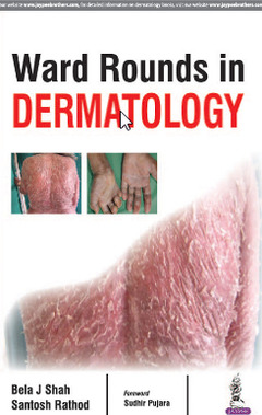 Couverture de l’ouvrage Ward Rounds in Dermatology