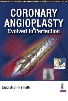 Couverture de l’ouvrage Coronary Angioplasty