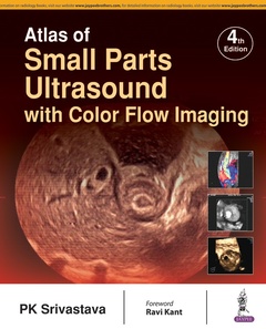 Couverture de l’ouvrage Atlas of Small Parts Ultrasound