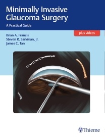 Couverture de l’ouvrage Minimally Invasive Glaucoma Surgery 