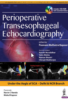 Cover of the book Perioperative Transeasophageal Echocardiograph