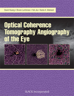 Cover of the book Optical Coherence Tomography Angiography of the Eye