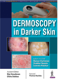 Couverture de l’ouvrage Dermoscopy in Darker Skin