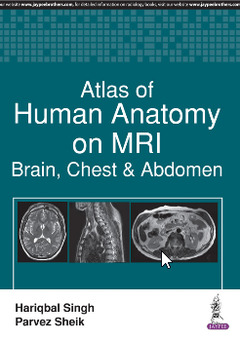 Couverture de l’ouvrage Atlas of Human Anatomy on MRI