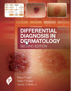 Couverture de l’ouvrage Differential Diagnosis in Dermatology