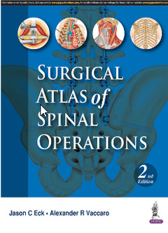Couverture de l’ouvrage Surgical Atlas of Spinal Operations