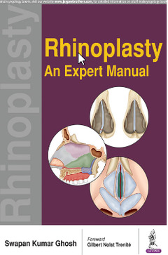 Cover of the book Rhinoplasty