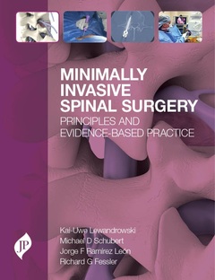 Couverture de l’ouvrage Minimally Invasive Spinal Surgery