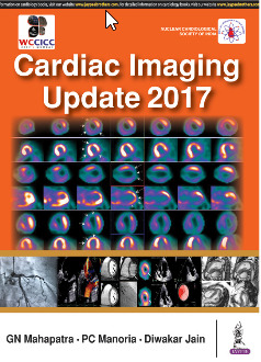 Cover of the book Cardiac Imaging Update 2017