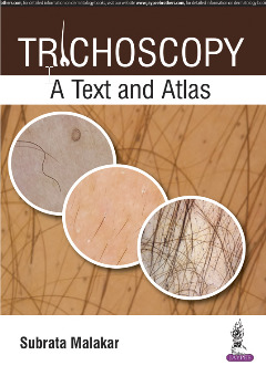 Cover of the book Trichoscopy