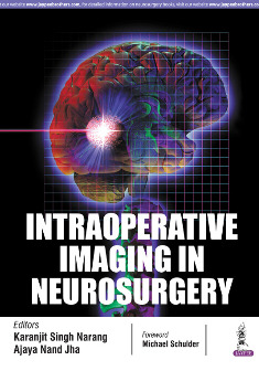 Cover of the book Intraoperative Imaging in Neurosurgery