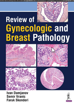 Couverture de l’ouvrage Review of Gynecologic and Breast Pathology