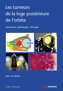 Cover of the book Les tumeurs de la loge postérieure de l'orbite - Tome 2