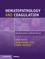 Couverture de l’ouvrage Hematopathology and Coagulation