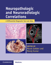 Couverture de l’ouvrage Neuropathologic and Neuroradiologic Correlations