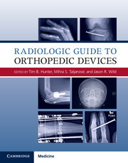Couverture de l’ouvrage Radiologic Guide to Orthopedic Devices