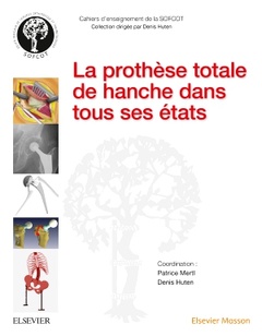 Cover of the book La prothèse totale de hanche dans tous ses états