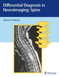 Couverture de l’ouvrage Differential Diagnosis in Neuroimaging 