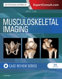 Couverture de l’ouvrage Musculoskeletal Imaging: Case Review Series