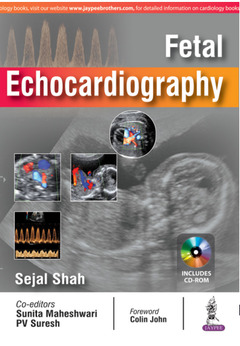 Couverture de l’ouvrage Fetal Echocardiography