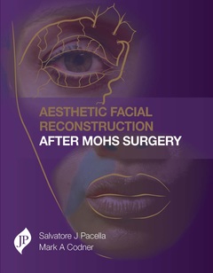 Couverture de l’ouvrage Aesthetic Facial Reconstruction After Mohs Surgery