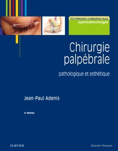 Couverture de l’ouvrage Chirurgie palpébrale