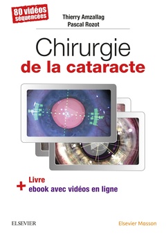 Couverture de l’ouvrage Chirurgie de la cataracte
