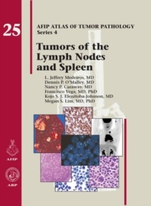 Couverture de l’ouvrage AFIP Atlas of Tumor Pathology Series 4 - Volume 25 - Tumors of the Lymph nodes and Spleen