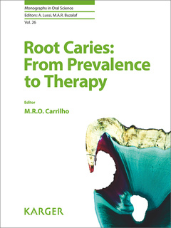 Cover of the book Root Caries: From Prevalence to Therapy