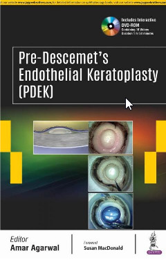 Couverture de l’ouvrage Pre-Descemet's Endothelial Keratoplasty (PDEK)