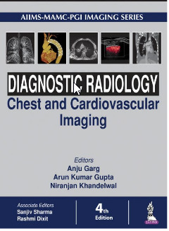 Couverture de l’ouvrage Diagnostic Radiology: Chest and Cardiovascular Imaging